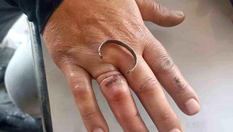 Hatay’da İtfaiye Takımları Vatandaşın Parmağına Sıkışan Yüzüğü Çıkardı